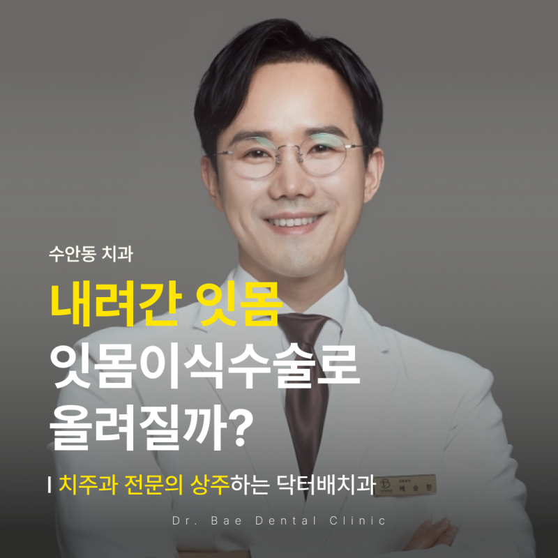 교정후 잇몸퇴축 이식으로 되돌릴 수 있을까?