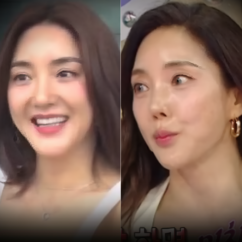 S.E.S 바다, 라디오스타 "성형 의혹 정면승부" 직접 꺼낸 뜻밖의 해명