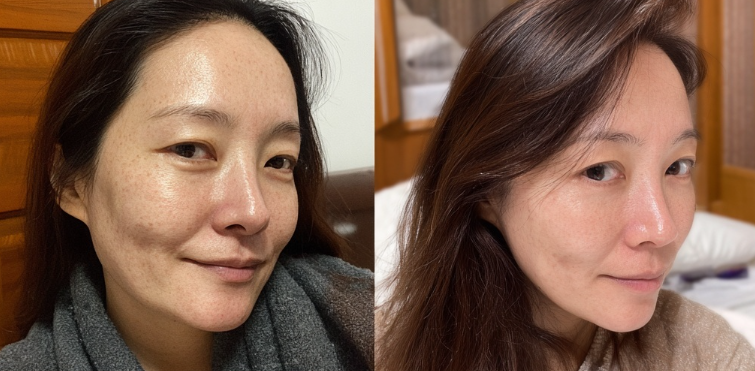 글루타치온 먹는 시간 식후 복용법 이것만 알면 끝