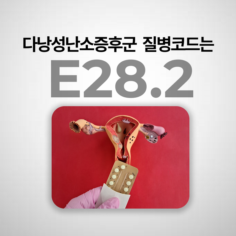 다낭성난소증후군 비용 실비보험청구되나요ㅣ질병코드