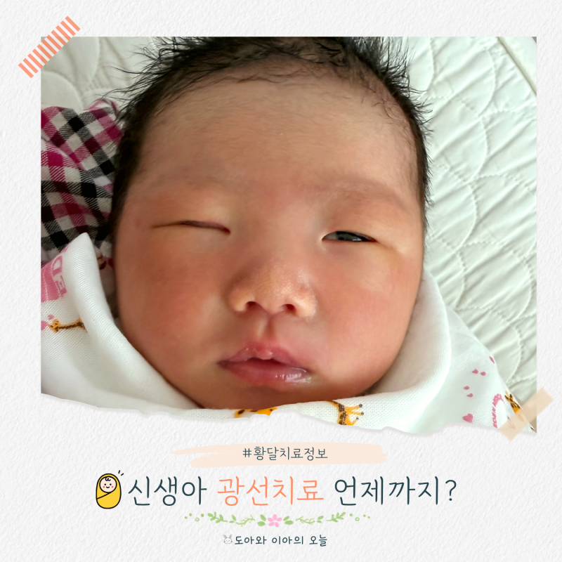 신생아 광선치료 언제까지? 황달 치료 꼭 해야 할까요?