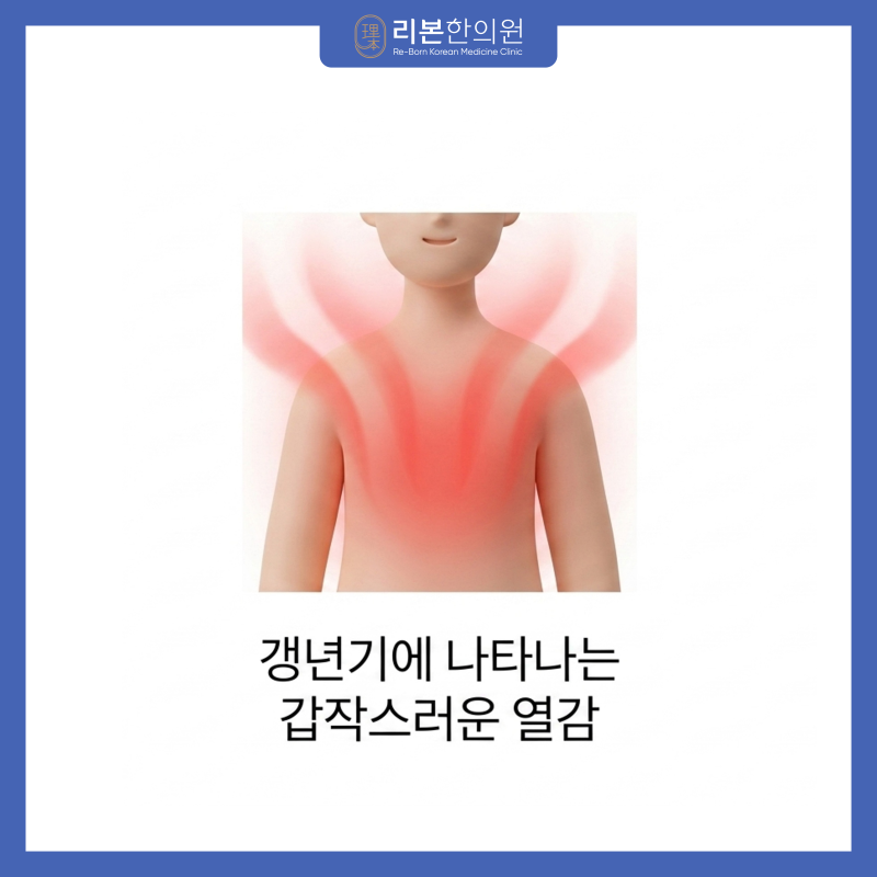 갱년기 상열감과 식은땀, 한의사가 말하는 근본 원인과 갱년기 한약