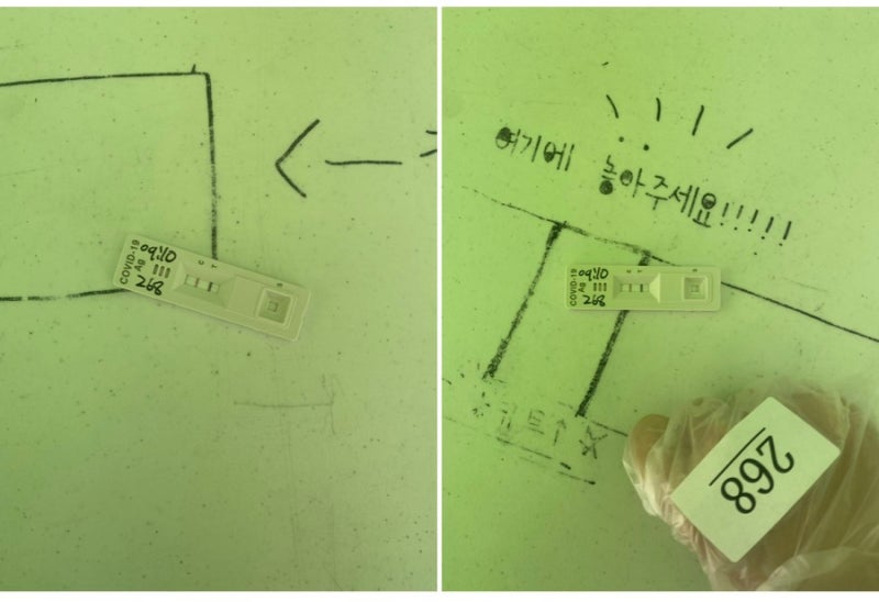 20대 여성의 자가면역질환 용혈성빈혈 판정받은 이야기 (1)