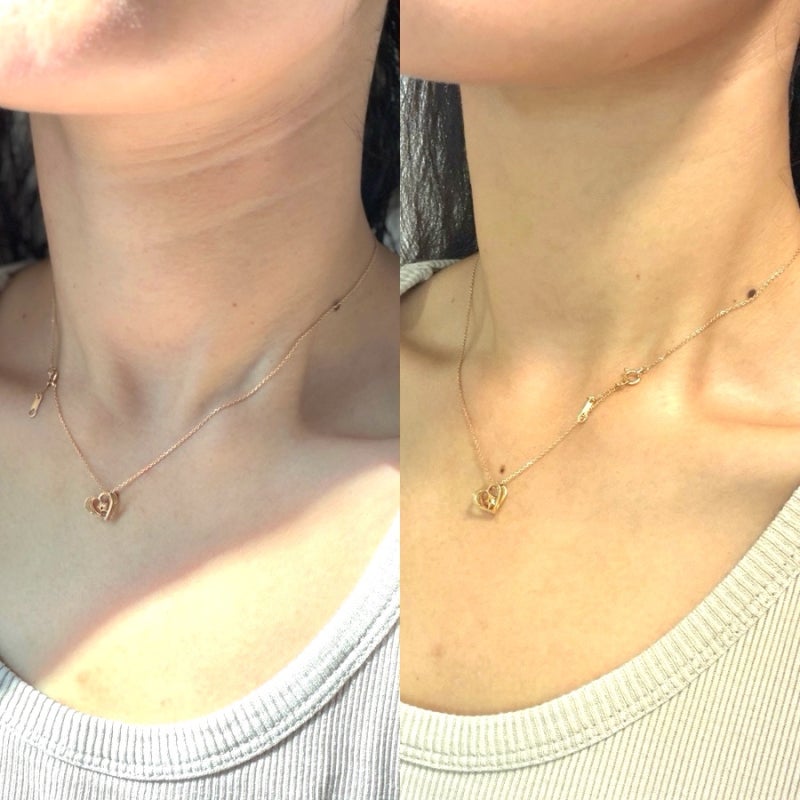 목주름팩 추천! 30~40대 부부가 함께 쓰는 재사용 가능 올킨스 넥테이프 주름패치 후기