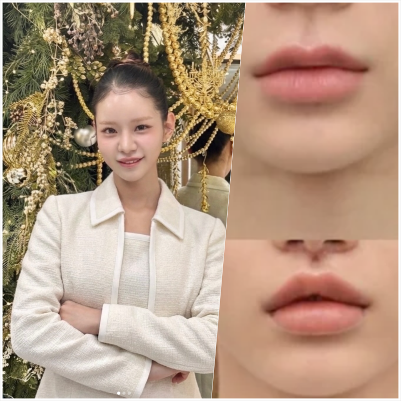 "맹승지 인중 축소수술 후기" 흉터 리얼공개 (+가을웜톤 메이크업까지 완벽)