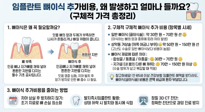 임플란트 뼈이식 추가비용, 왜 발생하고 얼마나 들까요? (구체적 가격 총정리)
