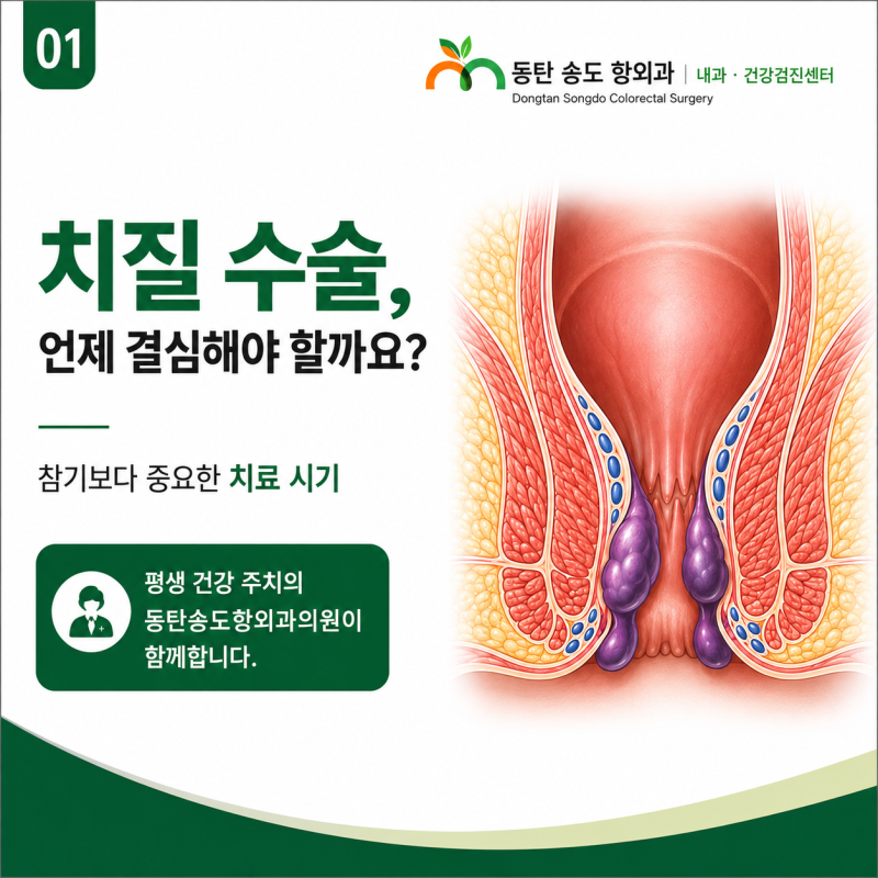 동탄항외과 치질 수술, 언제 결심해야 할까요?