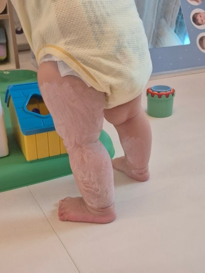 현대해상 수족구 청구방법 한번에 청구완료하는 팁