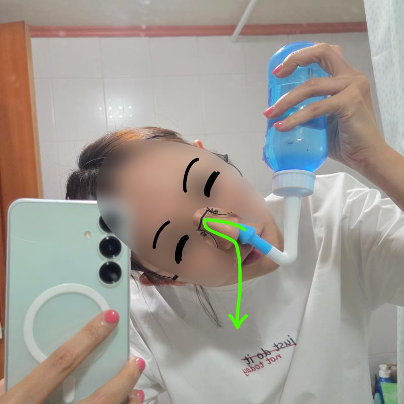 [광고]대의를 위해 제 얼굴 희생합니다. 비염 탈출 기원 N년차, 코세척 하는 법