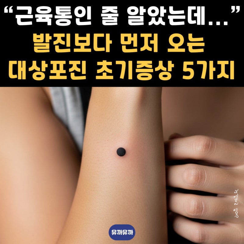 “근육통인 줄 알았는데...” 발진보다 먼저 오는 대상포진 초기증상 5가지