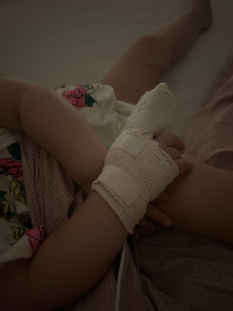 아기 손가락 베임 봉합수술 꼬맴 드레싱 상처주의