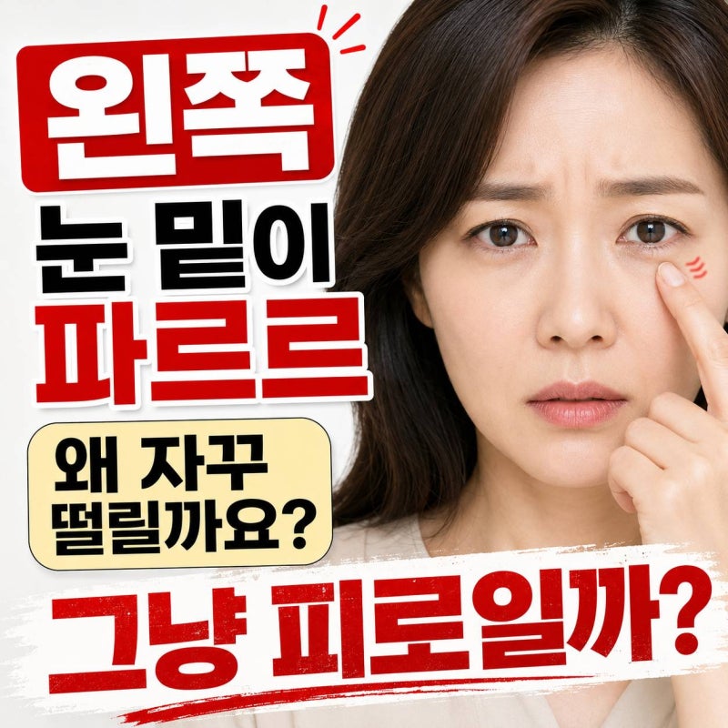 송탄역 안과, 송탄성모안과 : 왼쪽 아래 눈떨림 원인피곤해서일까요, 신경에 문제가 생긴 걸....