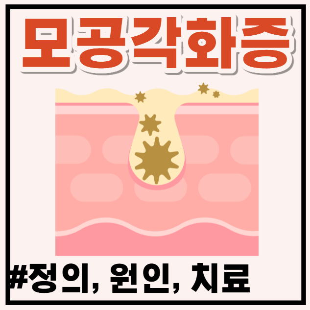 모공각화증 원인부터 원인 모를 닭살 피부 관리법 총정리