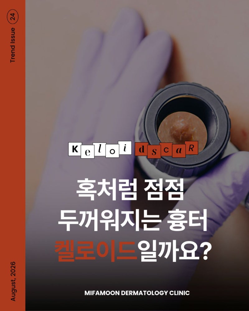 강남 켈로이드 피부과, 켈로이드 치료는 왜 피부과전문의의 진료가 중요할까요?