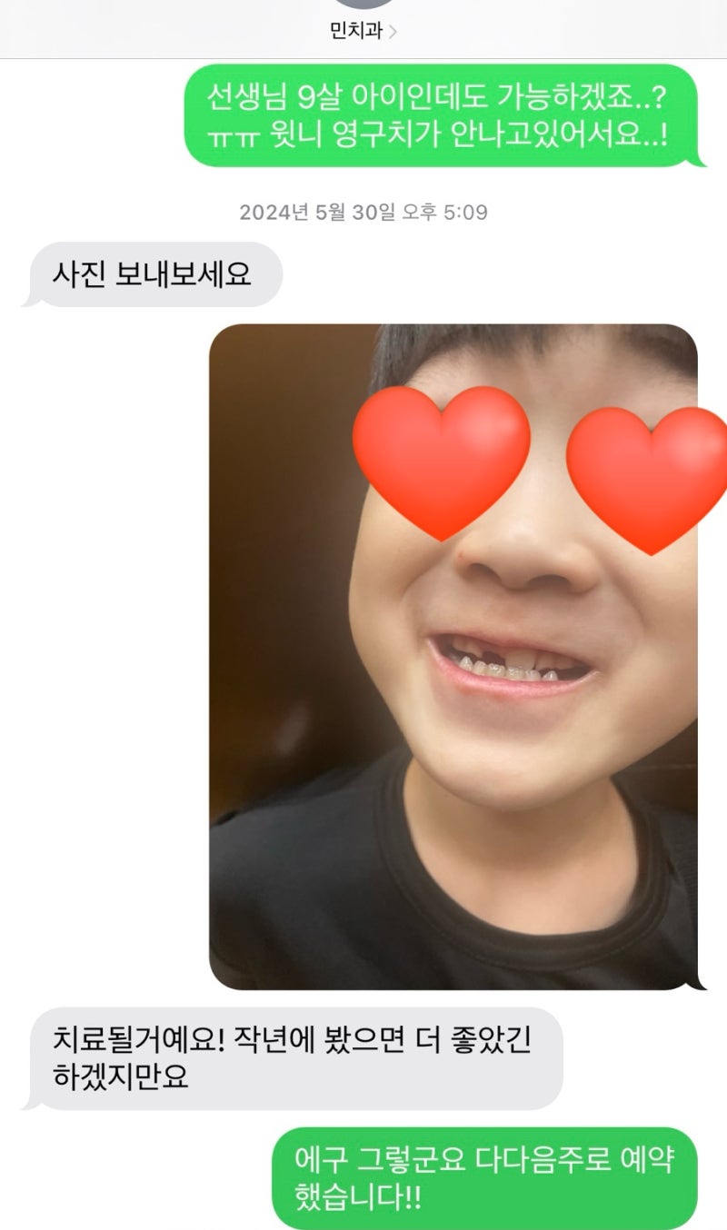 압구정 민치과 어린이부정교합 프랑켈 2년후기 -현대해상 보험접수까지