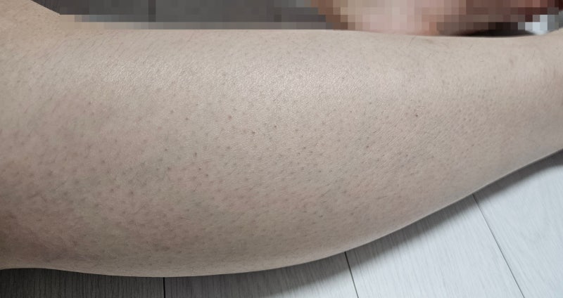 인스타 광고템 메디톨드 퍼시닌 바디워시 내돈내산 한달 사용후기