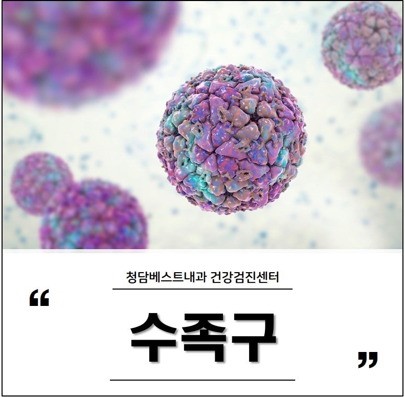 33배 급증한 수족구병 의심 증상과 격리 여부 & 기간