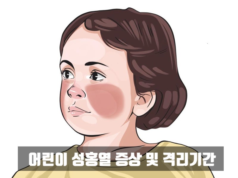 어린이 성홍열 증상 및 격리기간 총정리