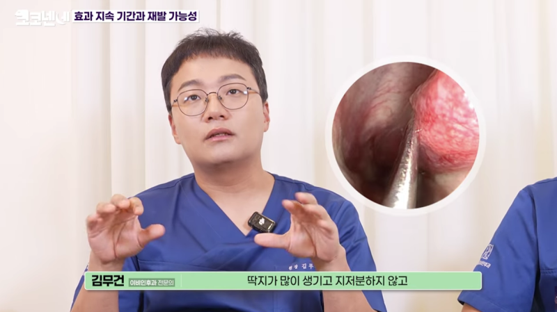 만성비염냉동치료란? 콧물 멈추는 법으로 좋은 치료?