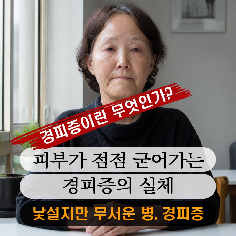손가락 끝이 하얗게 변한다면 의심해 봐야 할 질환