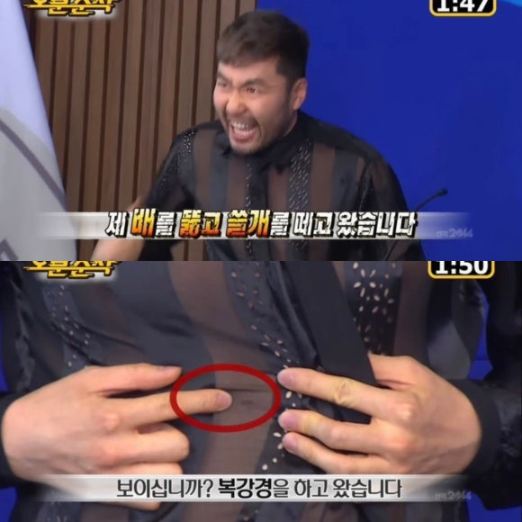 건강검진 담석 발견 후 담낭제거수술 후기 1편 담석 증상·외래 검사·복강경 수술 당일