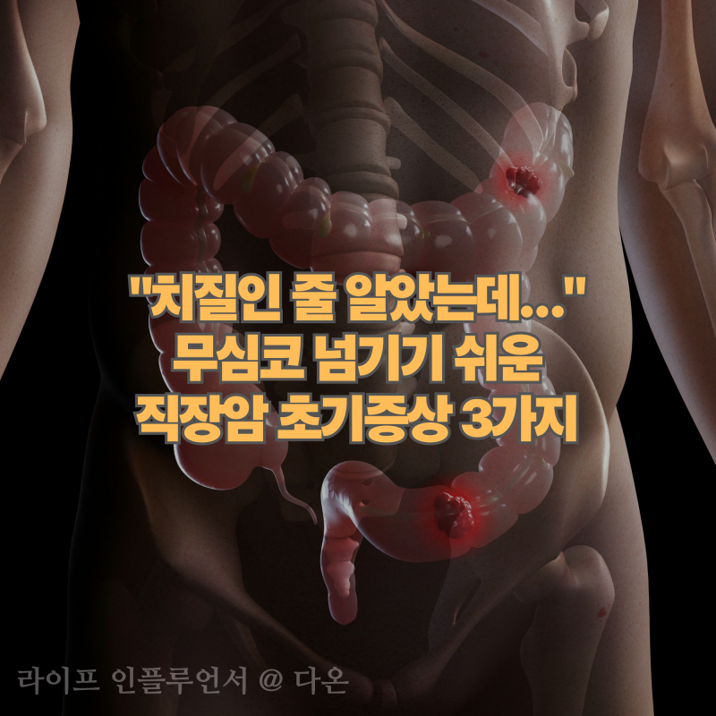 "치질인 줄 알았는데..." 무심코 넘기기 쉬운 직장암 초기증상 3가지