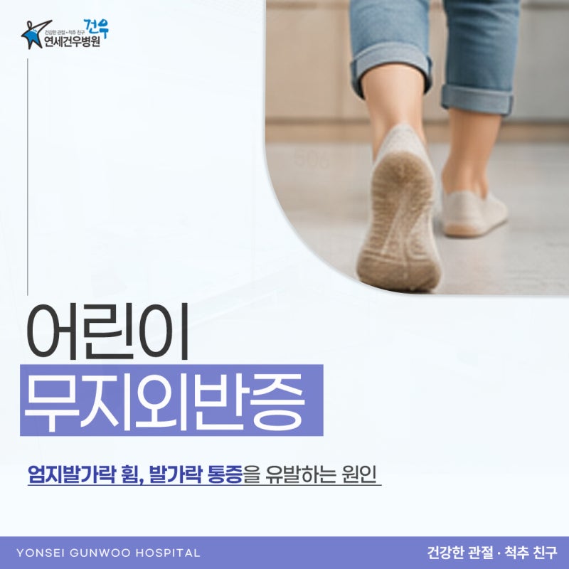 어린이 무지외반증, 발가락은 휘었는데 아이가 아프지 않다면?