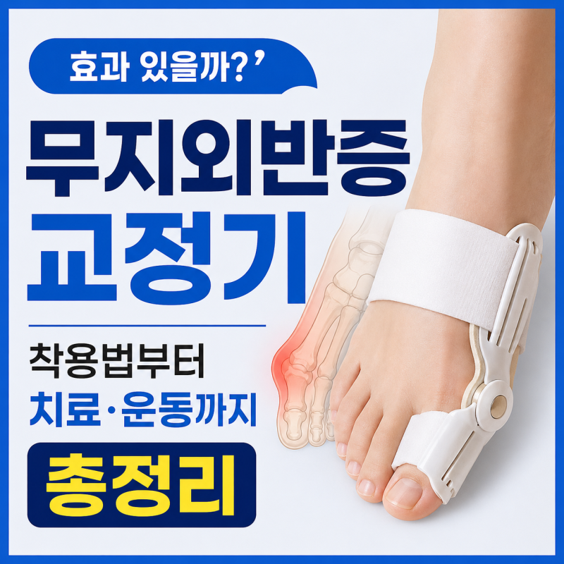 무지외반증 교정기 효과 있을까? 착용법부터 치료·운동까지 총정리
