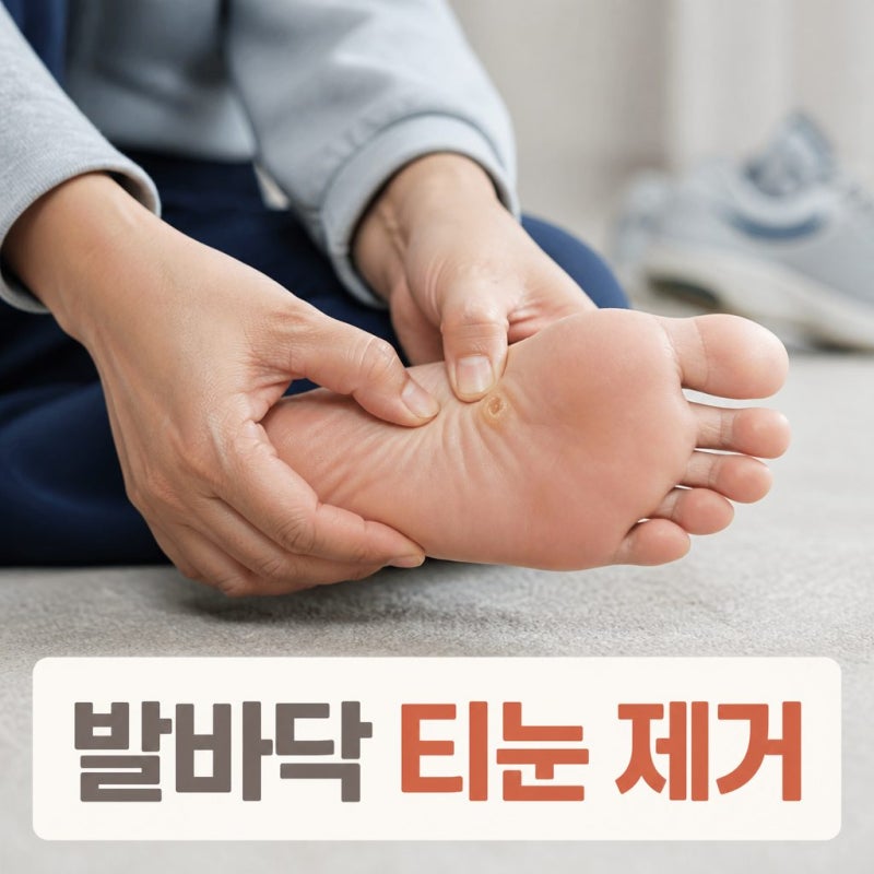 발바닥티눈제거 어떻게 할까? 사마귀와 구분부터 제거 방법까지