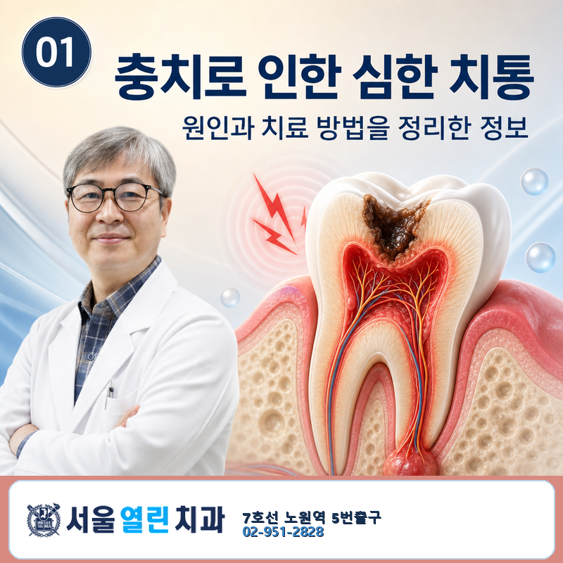 [노원 서울열린치과] 충치로 인한 심한 치통, 원인과 치료 방법 총정리