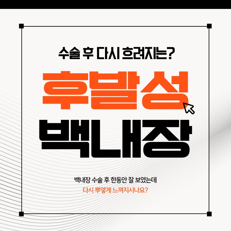 노원 백내장 안과, 수술 후 다시 흐려지는 후발성백내장?