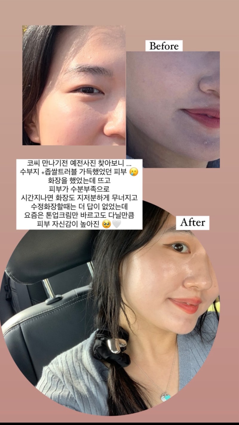 코씨 시카라인 비타라인 내돈내산 3년 사용 후기 & 9월 공구