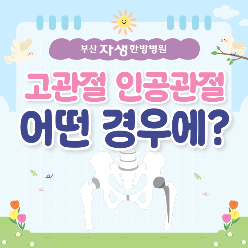 고관절 인공관절, 어떤경우에 인공관절을?