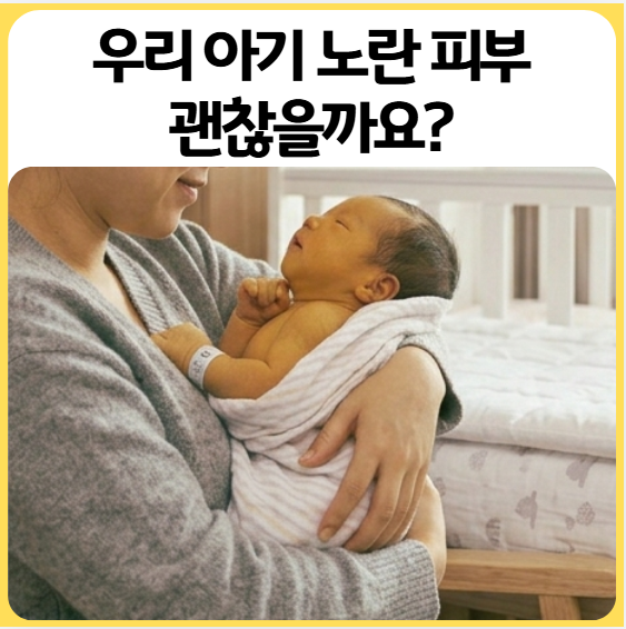 신생아 황달수치 | 안 떨어지면 어떻게 하나요?
