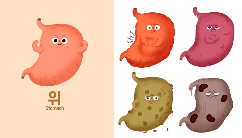 회복빠른 위경련 응급처치 추천하는 약은 뭘까?