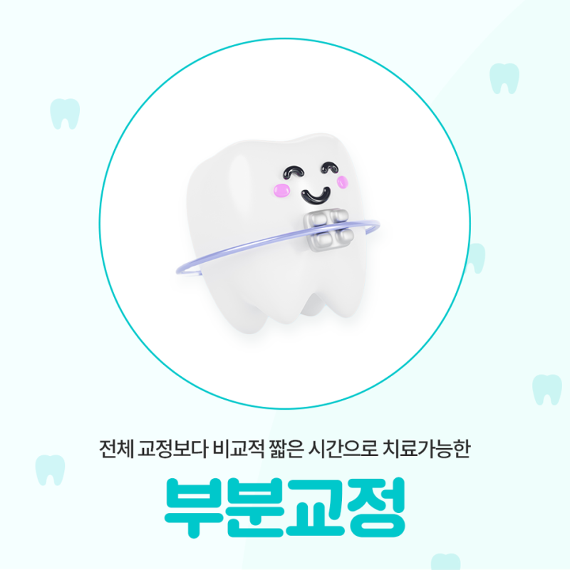 울산교정잘하는곳 앞니·아랫니 덧니 부분교정, 기간과 비용은 전체교정과 어떻게 다를까요?