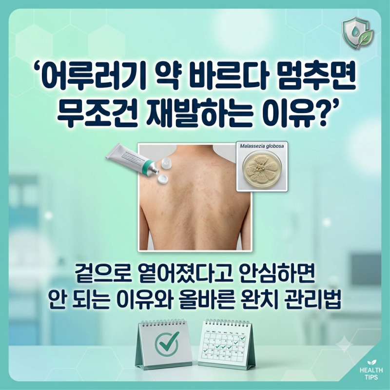 어루러기 옅어졌다고 멈추면 재발하는 이유