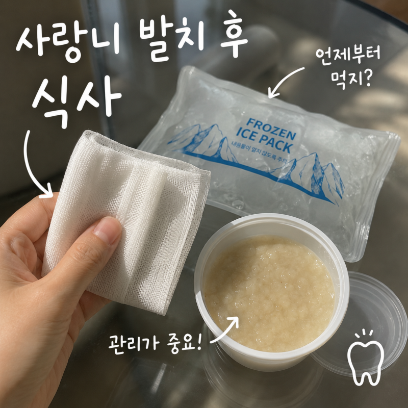 사랑니 발치후 식사 음식부터 통증 붓기 관리까지 한번에 정리!