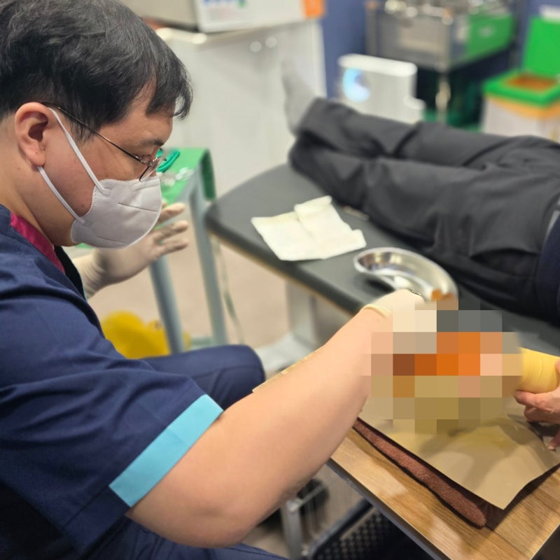 겨드랑이 피지낭종, 단순 뾰루지로 생각하면 안 됩니다