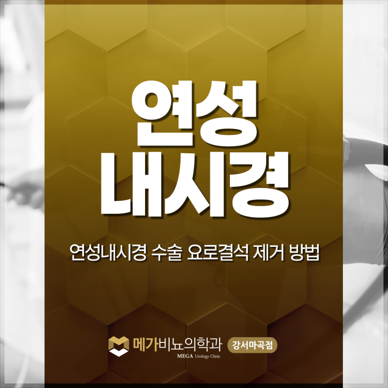 연성내시경 수술 요로결석 제거 방법과 장단점