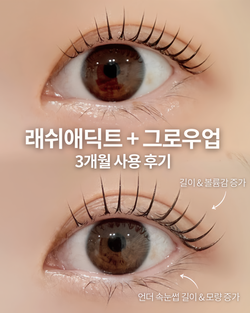 속눈썹 영양제 추천｜래쉬애딕트 + 그로우업 조합이 유명한 이유