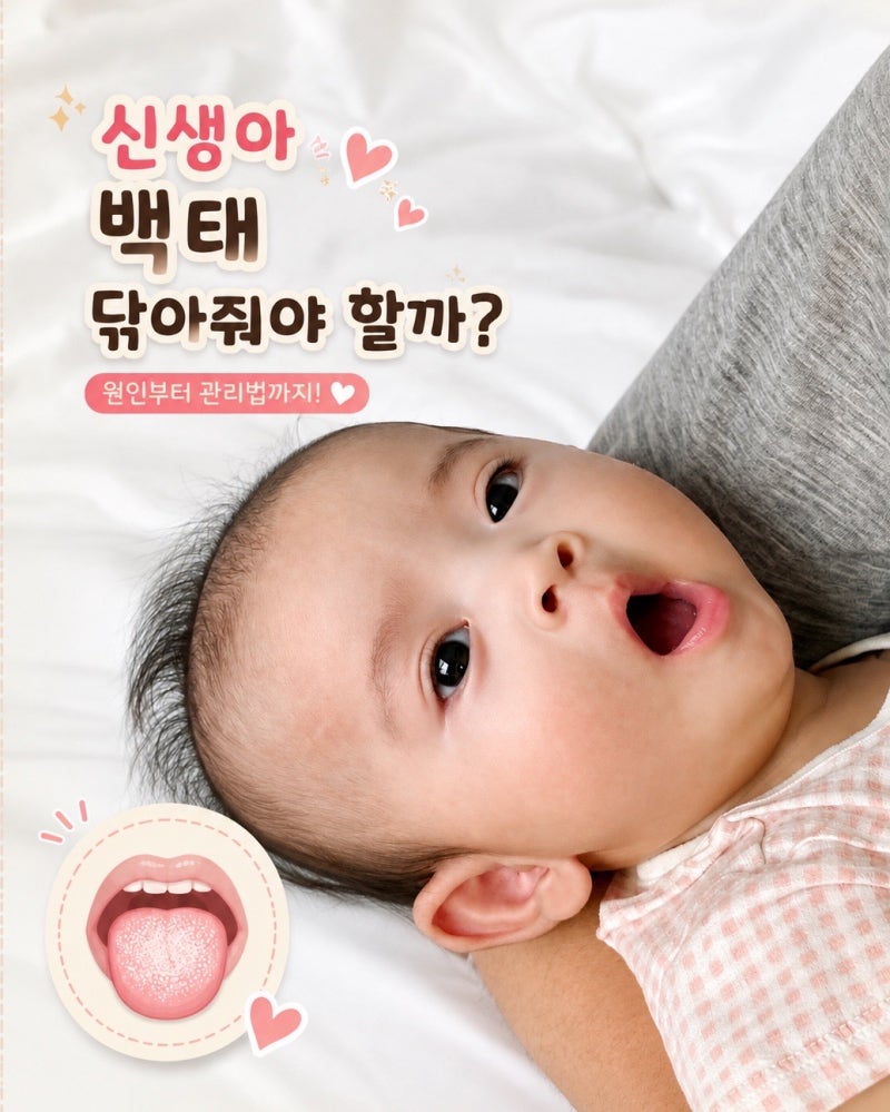 신생아 백태 언제 닦아야할까? 제거 시기와 관리방법