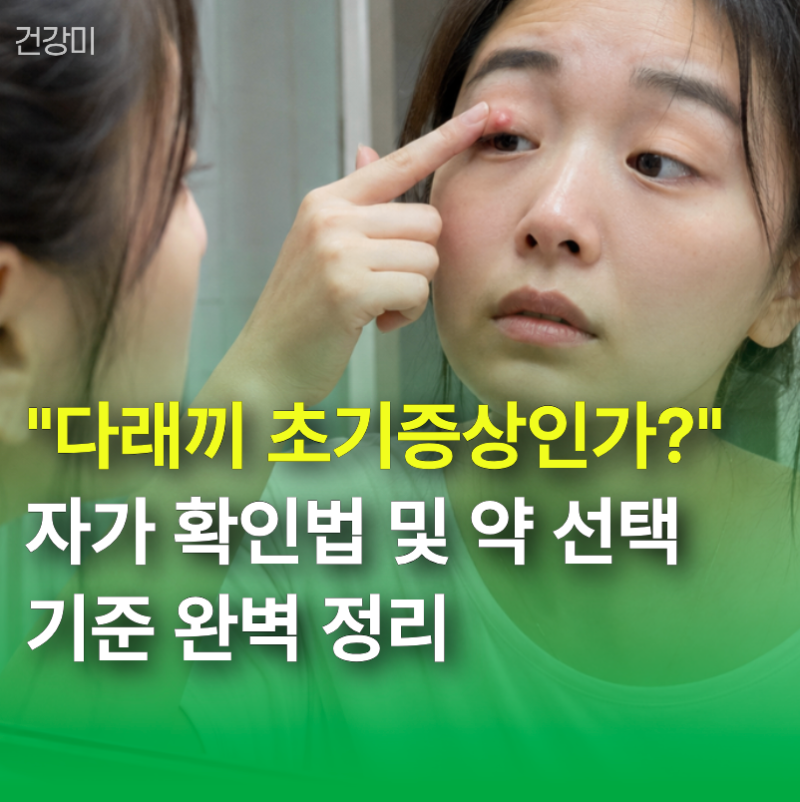 "다래끼 초기증상인가?" 자가 확인법과 약국 약 선택기준 완벽 정리