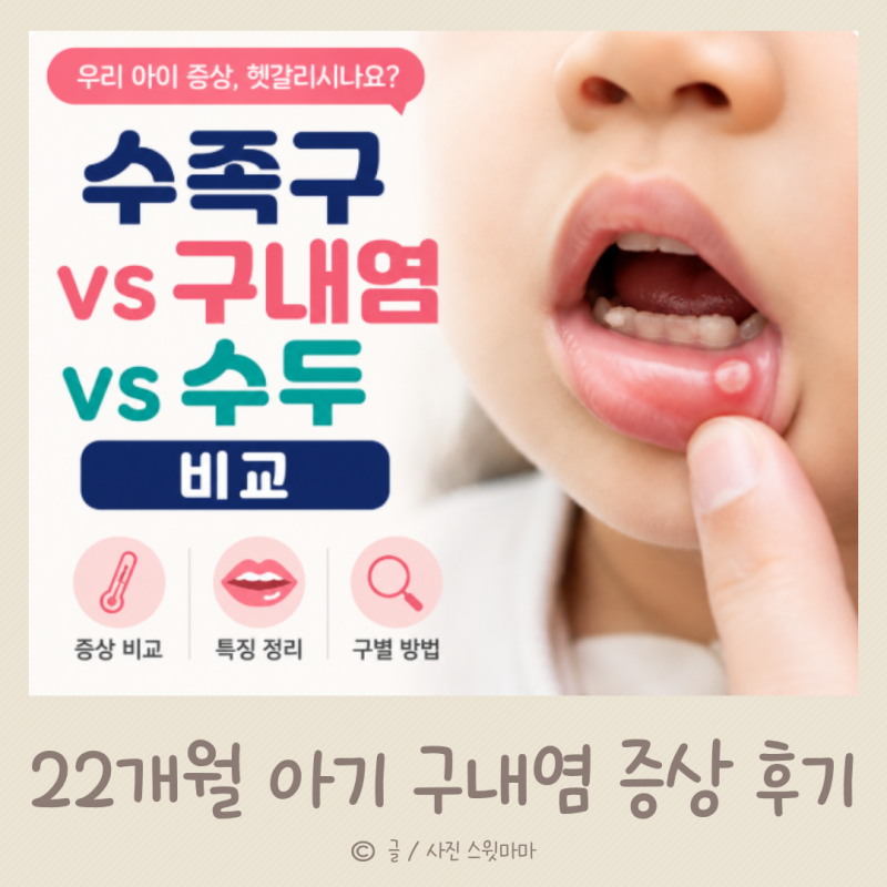 여름철 수족구 vs 구내염 vs 수두 비교 (ft.22개월아기 구내염 후기)
