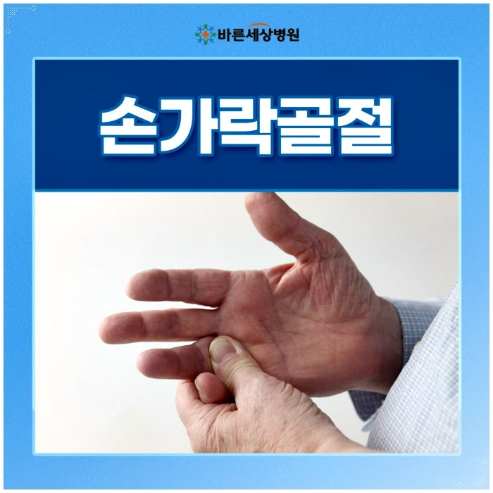 새끼손가락 미세골절 회복 기간 언제 움직일 수 있나요?