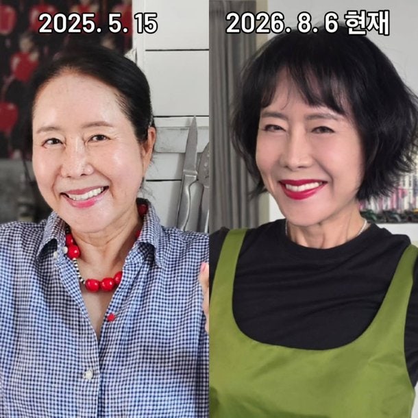 64세 윤영미, 10kg 감량과 안면거상으로 되찾은 전성기 비주얼