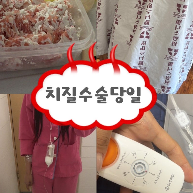 치질수술 당일 후기 | 부산 웰니스 병원 치질수술후기