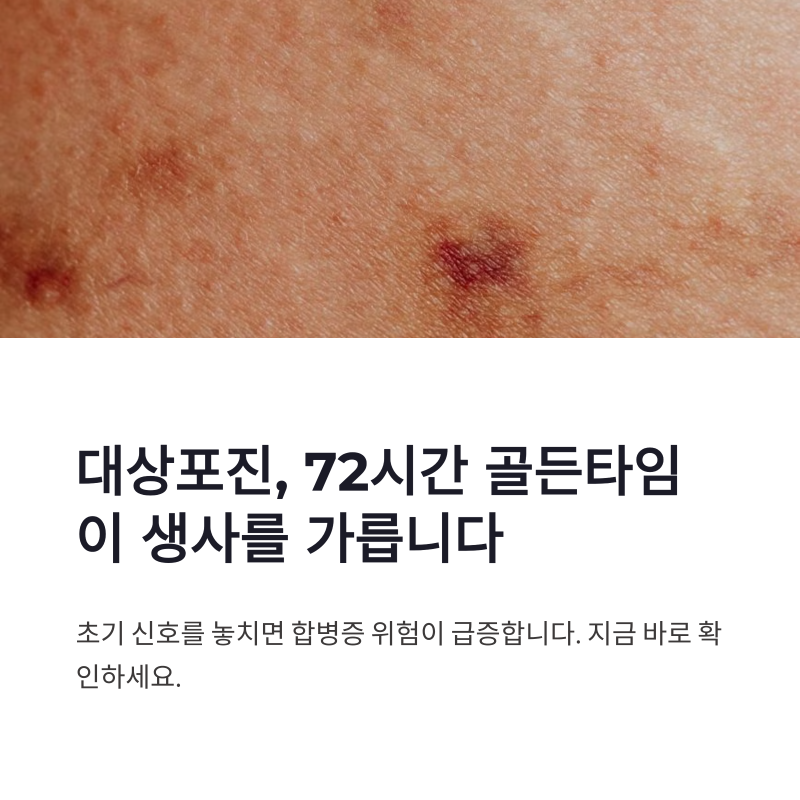 대상포진증상 초기 신호, 72시간 골든타임이 중요한 이유