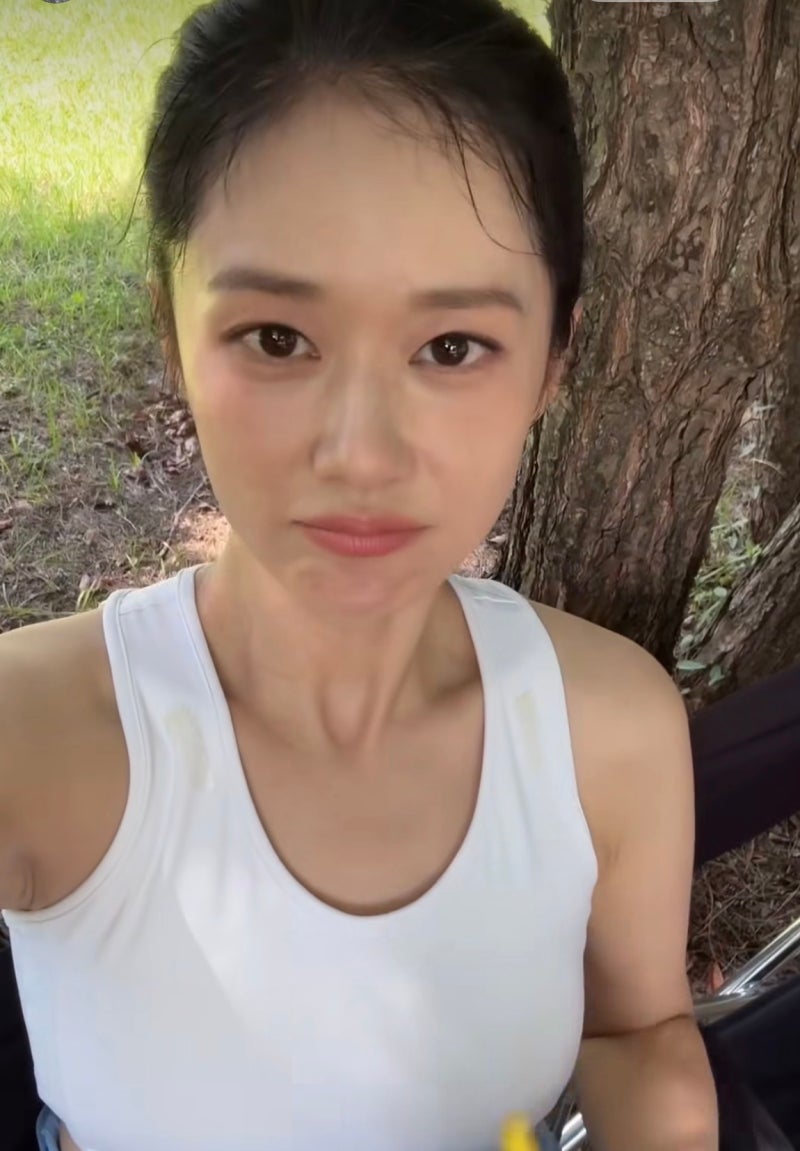 장나라 동안피부, 시술 대신 '이것'을 3시간마다 바른대요