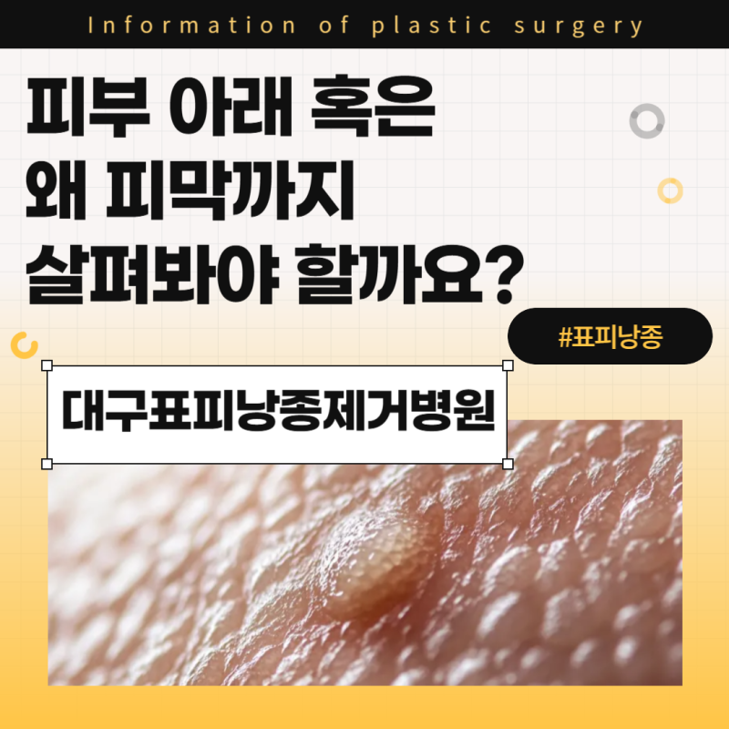 대구표피낭종제거병원, 피부 아래 혹은 왜 피막까지 살펴봐야 할까요?